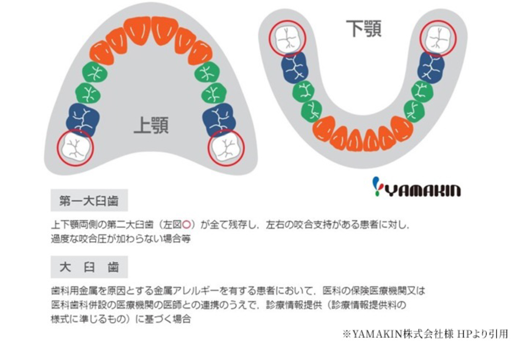 CADCAM冠適用部位についての画像