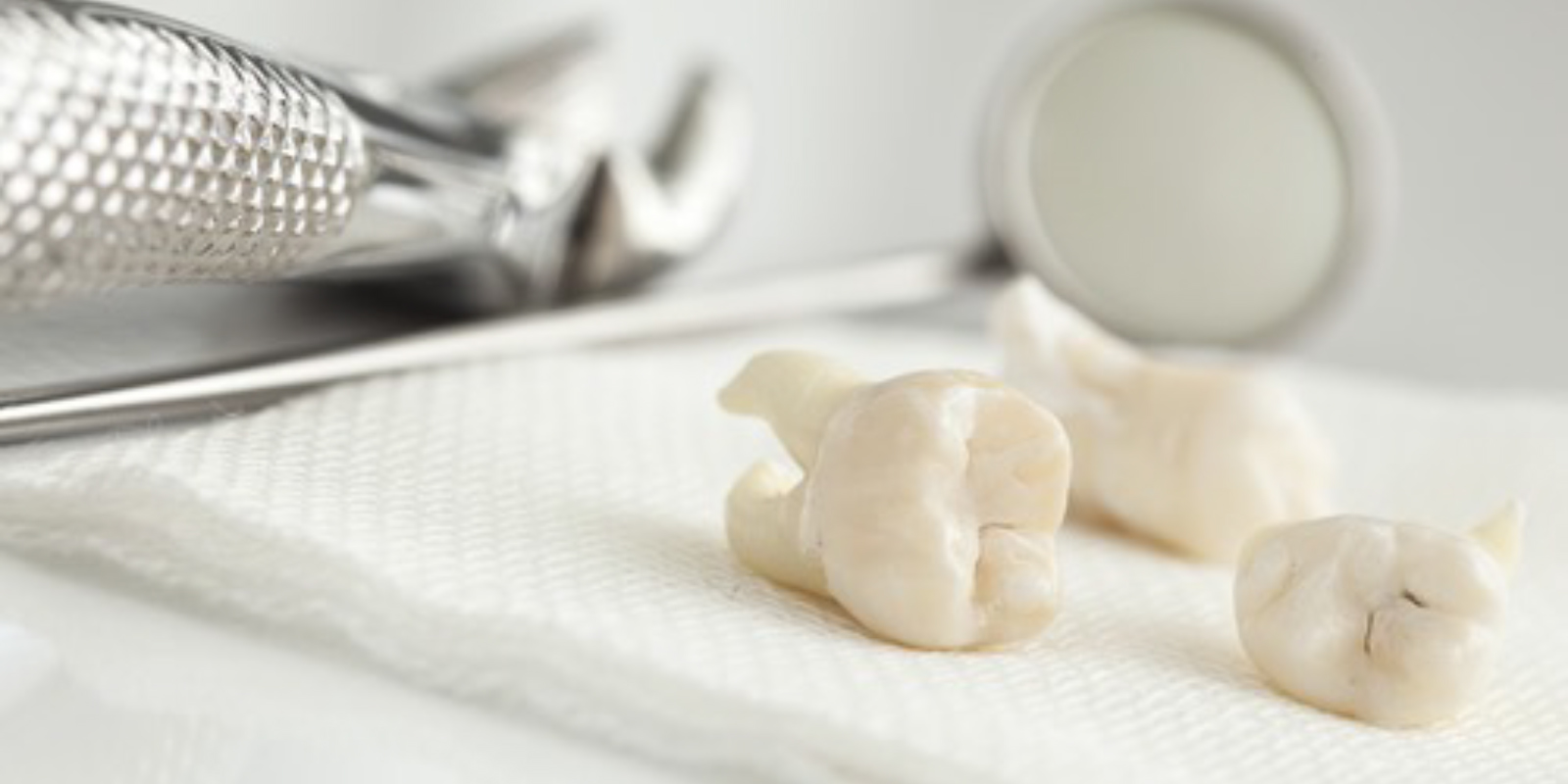 抜歯用の器具と、抜いた歯