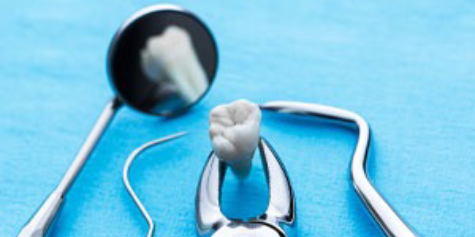 歯を抜くための器具で抜いた歯を掴んでいる