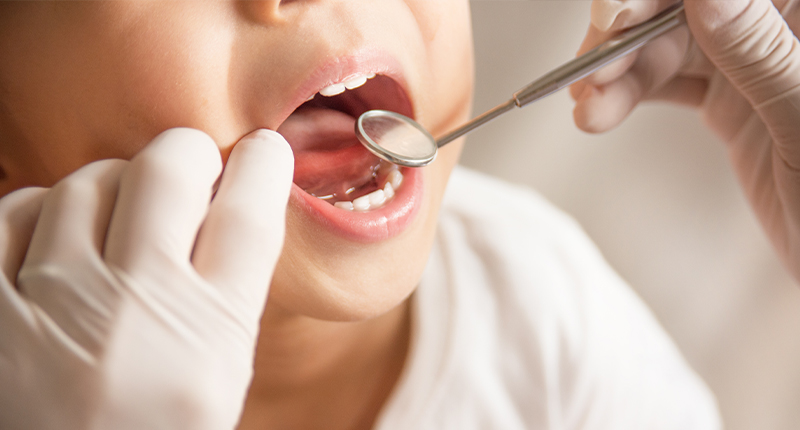 口の中を歯医者さんに見せる男の子