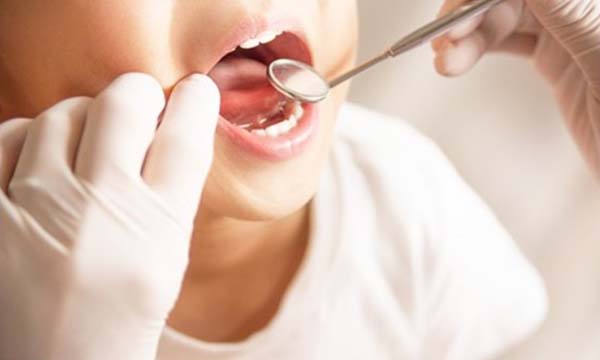 口の中を歯医者さんに見せる男の子