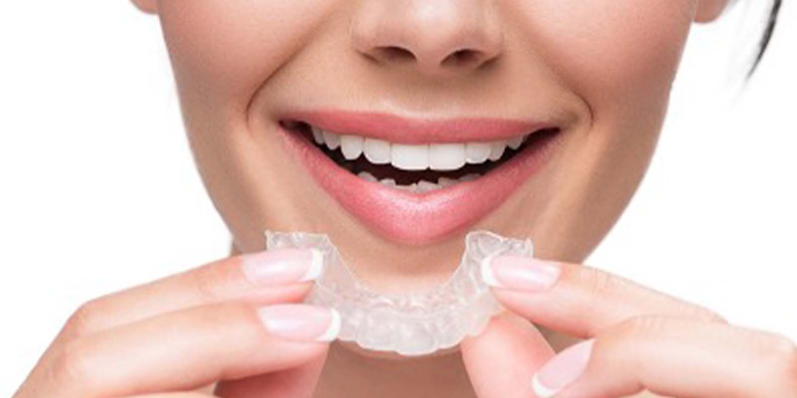 マウスピースをはめようと口元に近づける女性の口元の写真