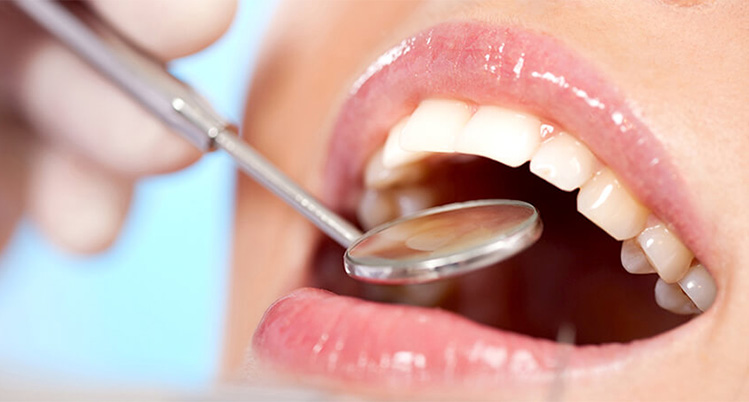 歯科医院で口腔内チェックを受けている様子