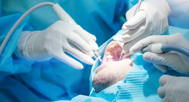 抜歯用の器具と、抜いた歯