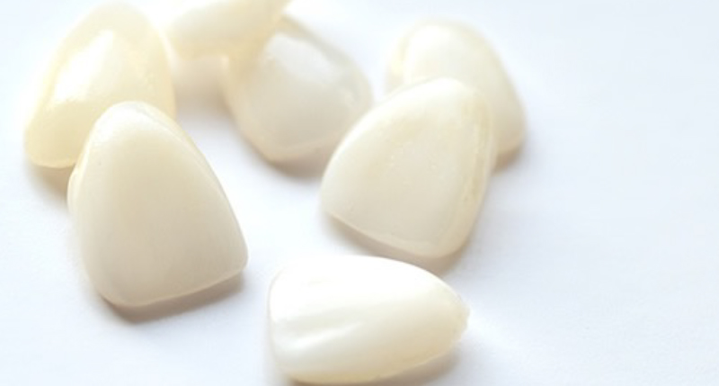 セラミックの歯の画像