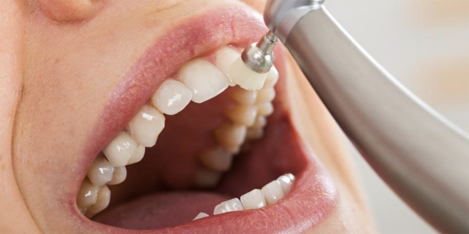 歯科医院の歯のクリーニング専用の機械で歯を磨かれている様子