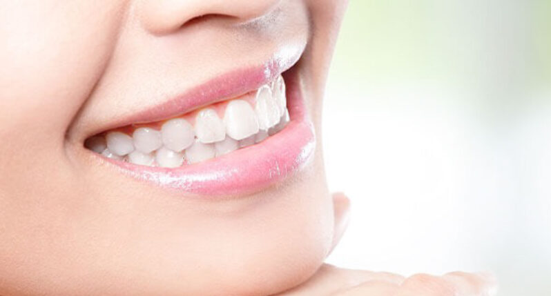 顎を手に置き、白い歯を見せながら微笑む女性の口元