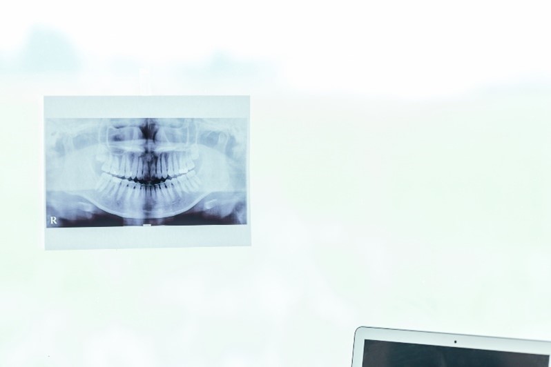 レントゲンを確認している様子