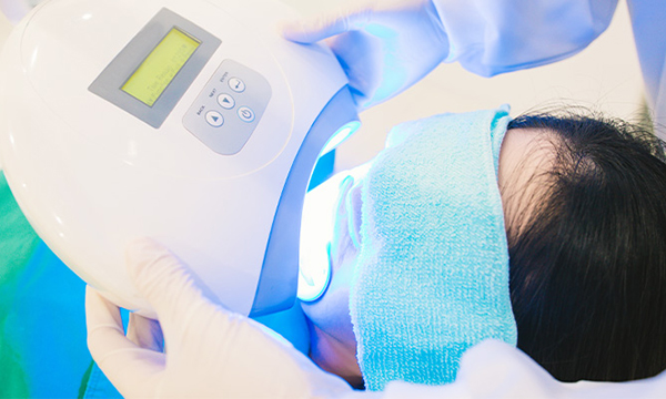 東松原歯科でオフィスホワイトニングを受けるイメージ