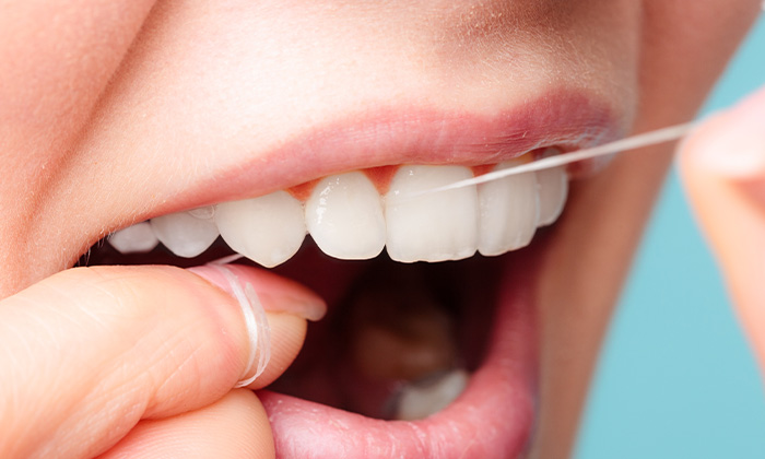 デンタルフロス