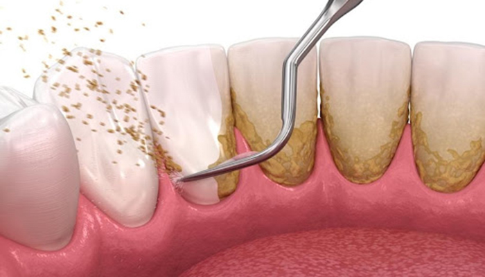 超音波の振動で汚れを落とすイメージイラスト