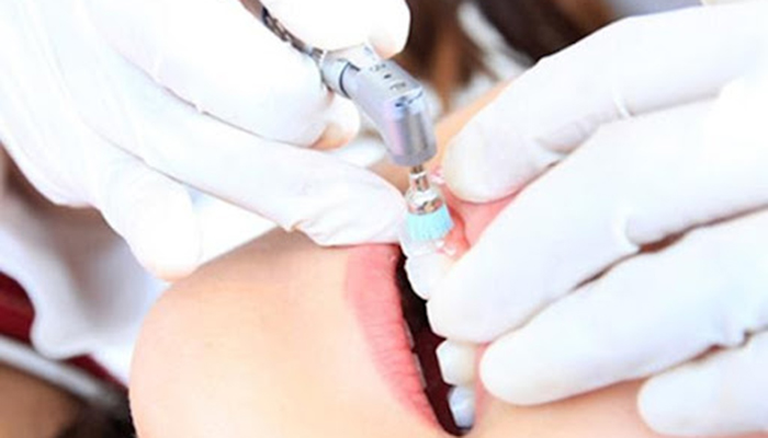 歯科医院の歯のクリーニング専用の機械で歯を磨かれている様子