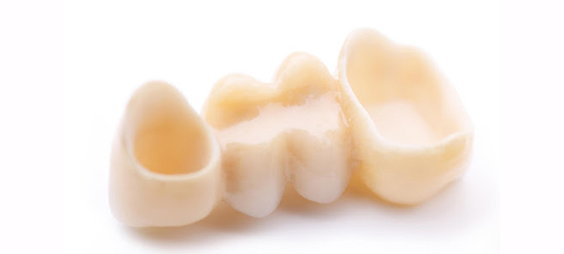 ブリッジのイメージ画像