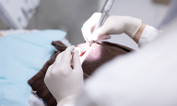 歯科医院で治療を受けているイメージ