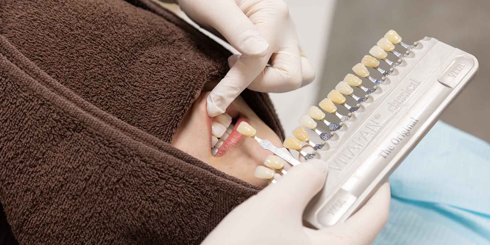 シェードガイドという色を確認するための歯の見本を歯に近づけ、色味の確認をしている様子