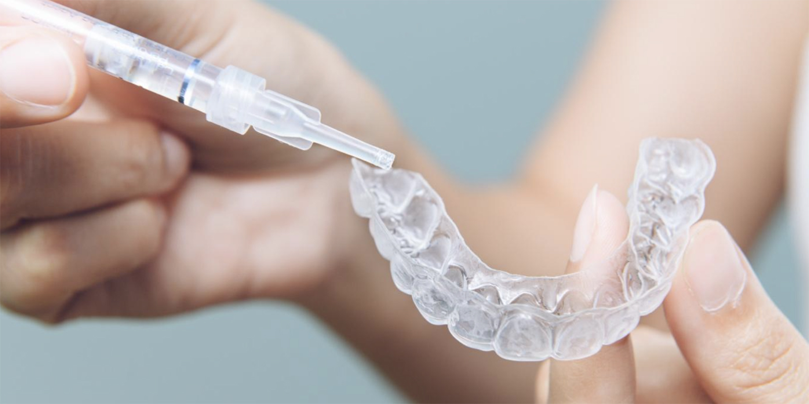 ホームホワイトニングのトレーにホワイトニングジェルを塗布している様子