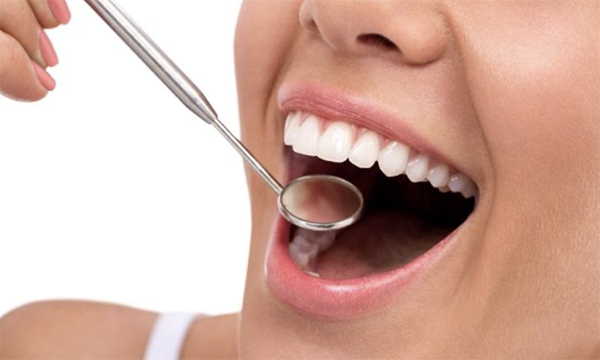 歯科医院で口腔内チェックを受けている様子