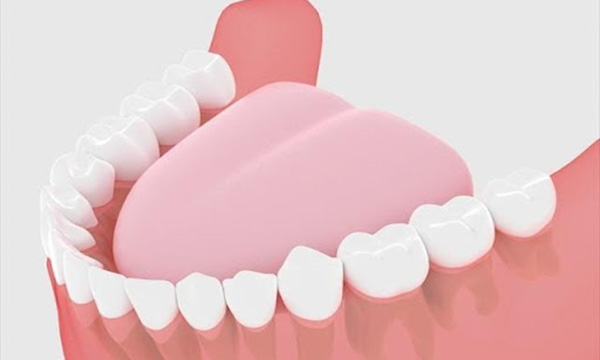 親知らずが生えそろっている下の歯のイラスト