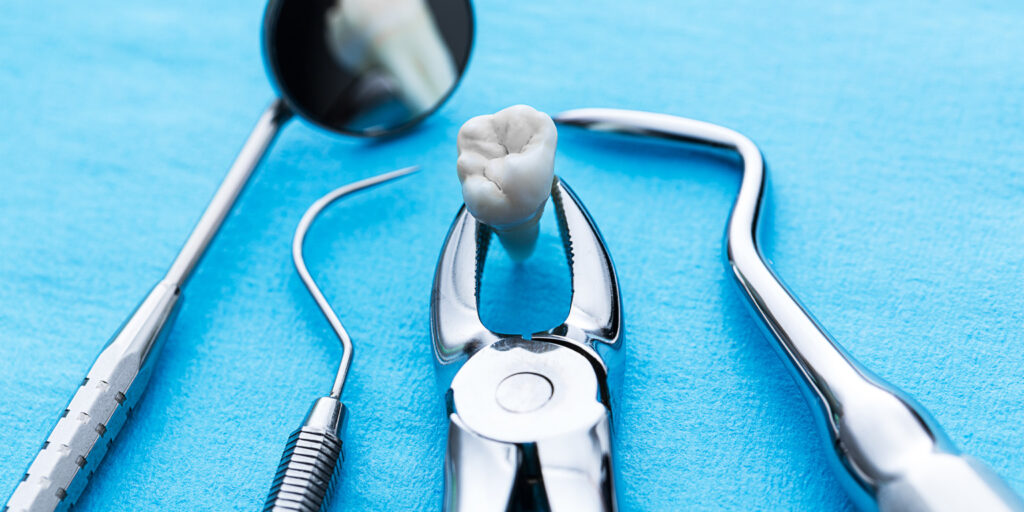 歯を抜くための器具で抜いた歯を掴んでいる