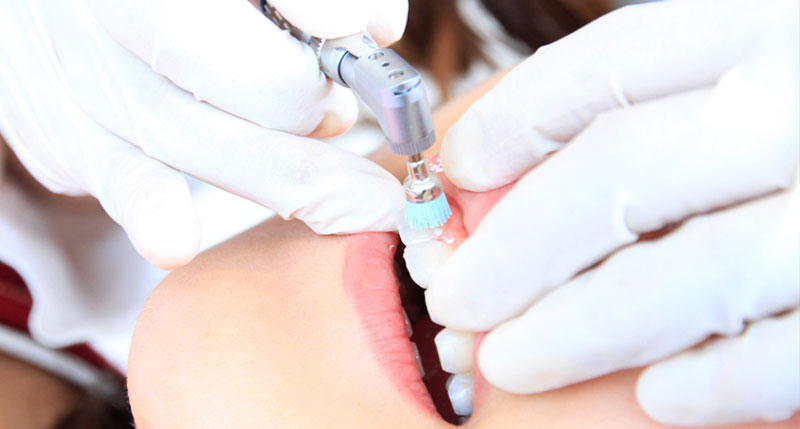 歯科医院の歯のクリーニング専用の機械で歯を磨かれている様子